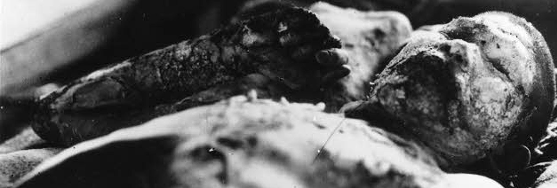 The atomic bombing of Hiroshima and Nagasaki